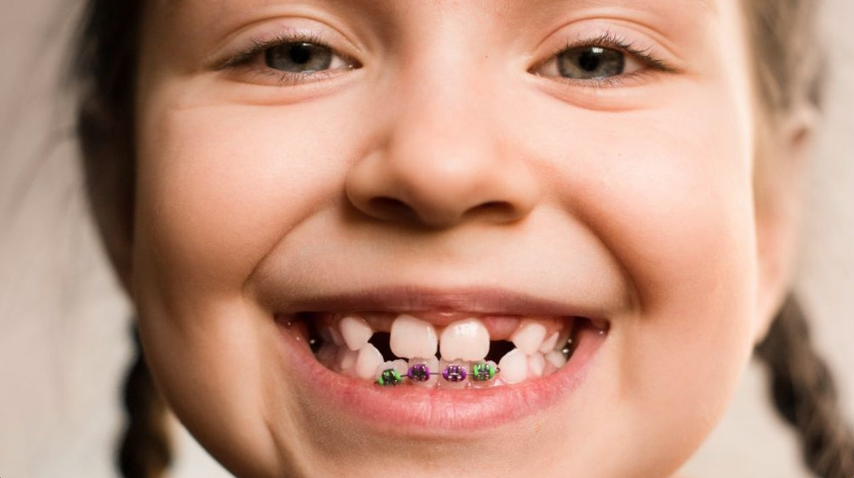 orthodontic problems